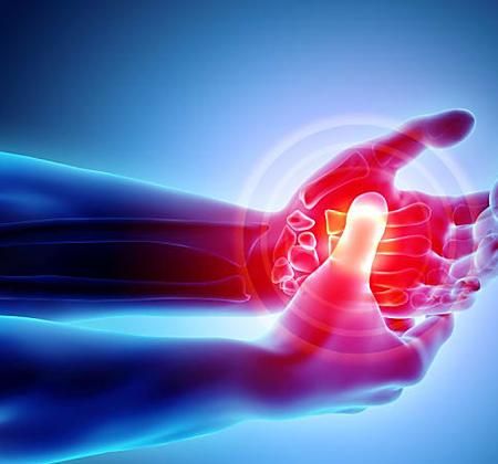 Rheumatoid Arthritis: 5 Innovative Treatments to Consider